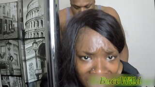 ���फादारी दर्दनाक गुदा 1